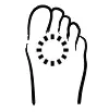 Neuroma Treatment