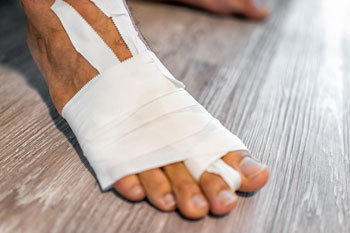 foot and ankle fractures